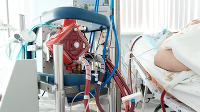ECMO